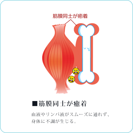 筋膜同士が癒着